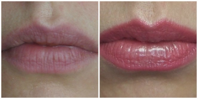 fuller_lips